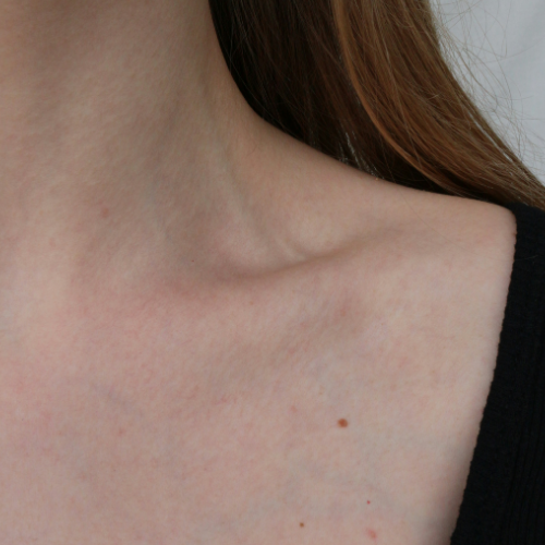 O estresse e o envelhecimento da pele