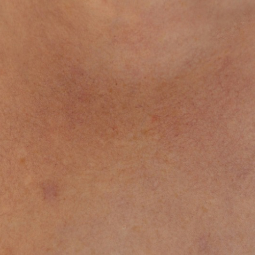 Alergia na pele: guia para manter a pele equilibrada e sem irritações